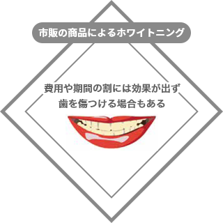 市販の商品によるホワイトニング：費用や期間の割には効果が出ず、歯を傷つける場合もある