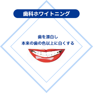 歯科ホワイトニング：歯を漂白し、本来の歯の色以上に白くする